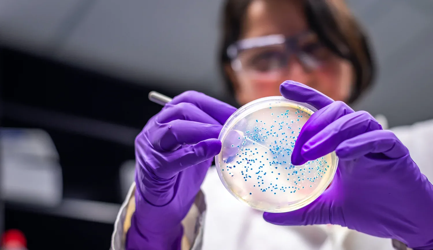 Woman Researcher Performing Examination Of Bacterial Culture Plate