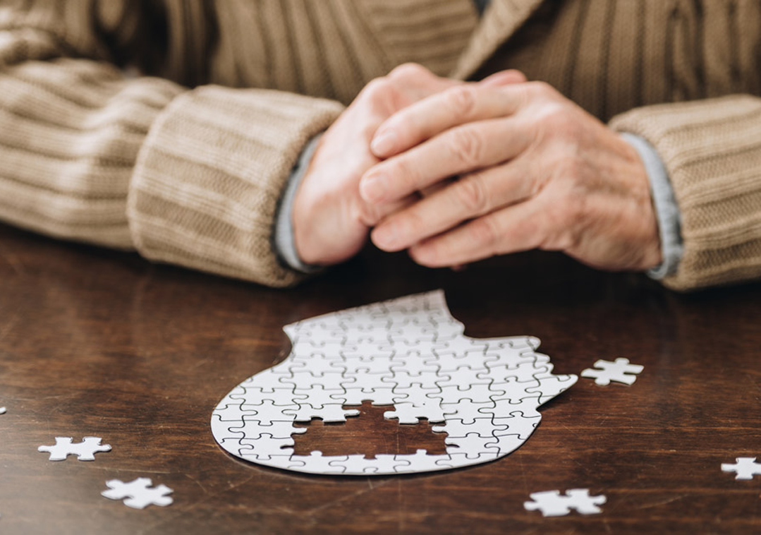 Dementia 241431741 Full Dementia 241431741 Full
