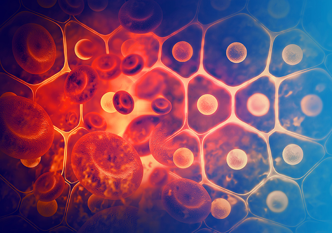 COVID-19 or a Blood Clot: How to Distinguish the Two